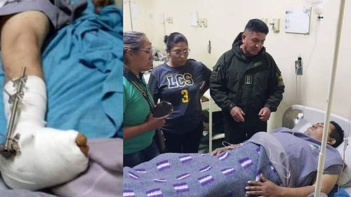 Cirujanos de la CNS logran salvar el pie del sargento herido en Parotani