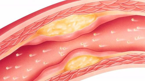 Estudio revela que la menopausia provoca cambios adversos en el perfil de colesterol de las mujeres