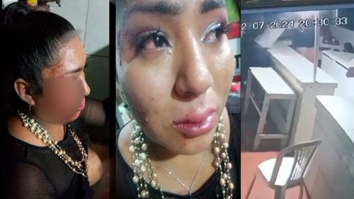 Mujer denuncia agresión por su pareja en TikTok y pide justicia